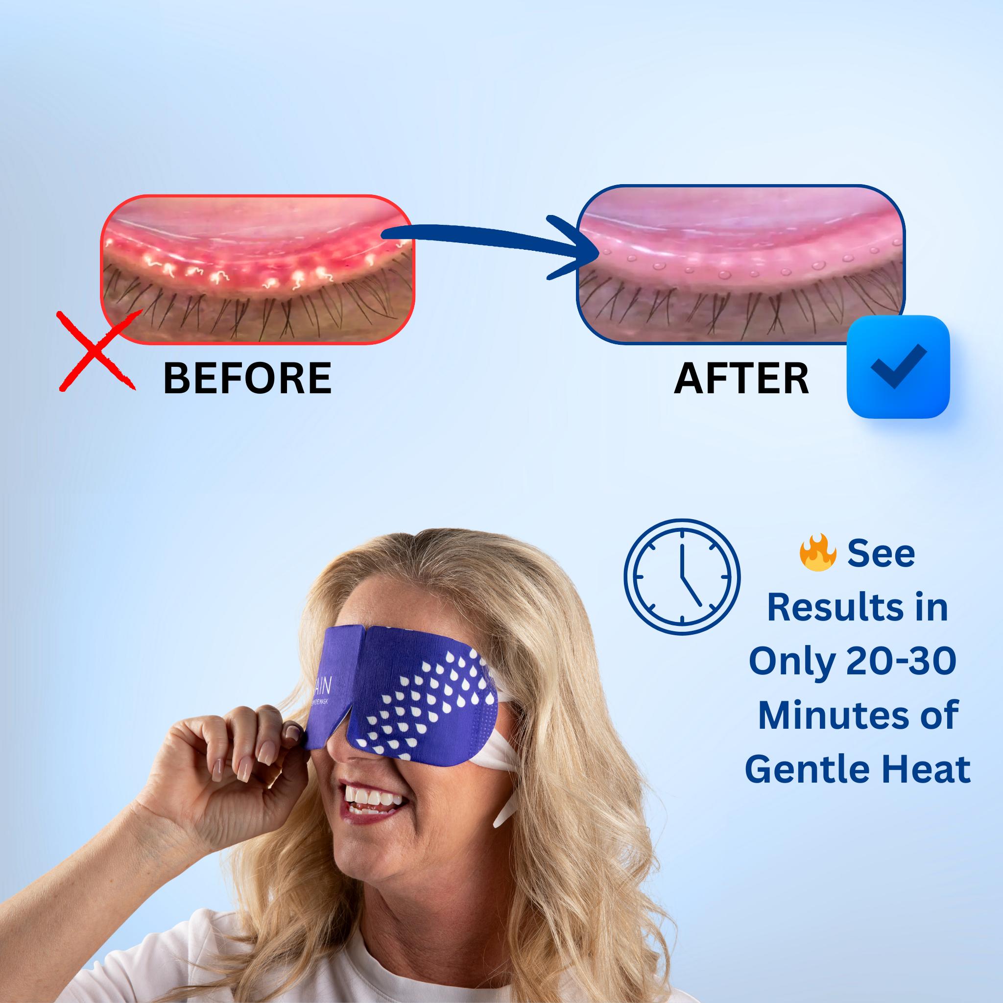 Rain Self-Heating Eye Masks - Buy 1 Get 1 FREE